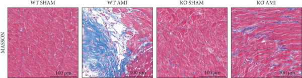 Figure 22