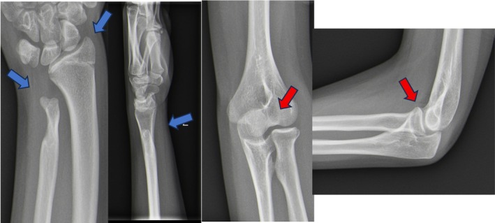 FIGURE 2