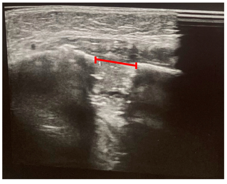 Figure 8