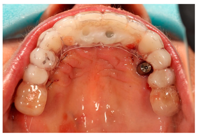 Figure 6