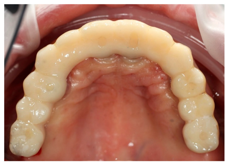 Figure 9