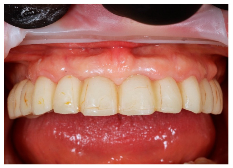 Figure 10