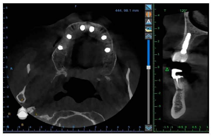 Figure 11
