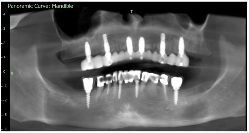 Figure 12