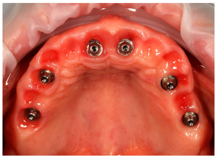 Figure 13