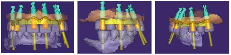 Figure 15