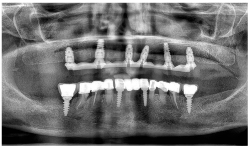 Figure 16