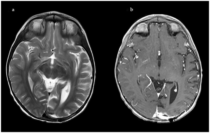 Figure 13