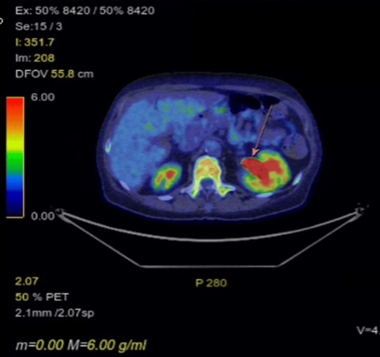 Figure 6