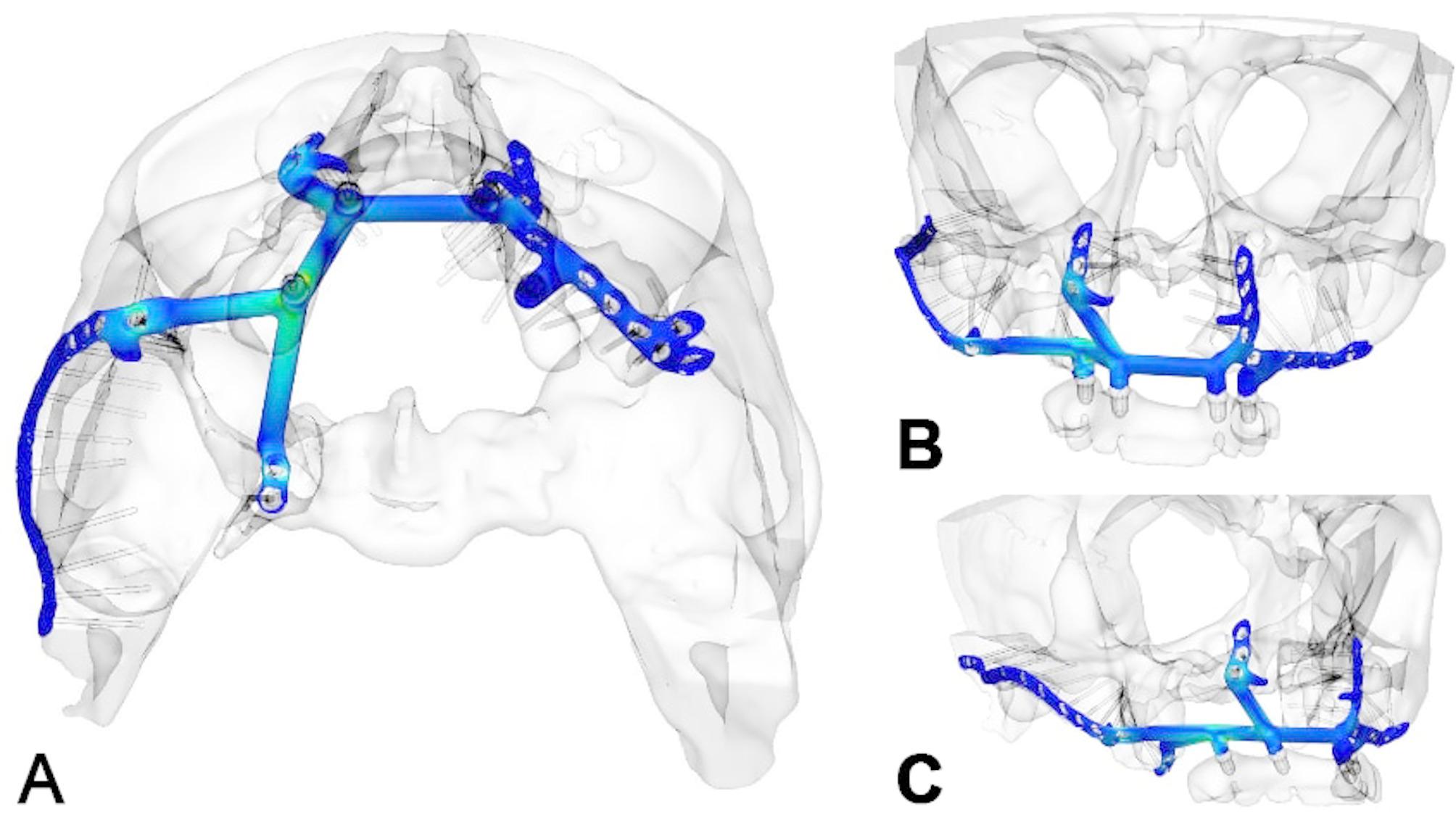 Figure 10