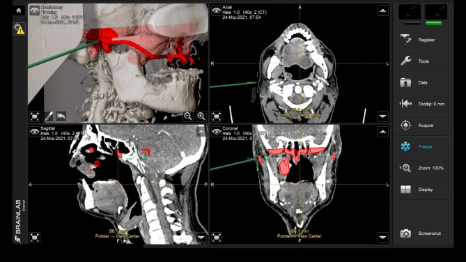 Figure 12