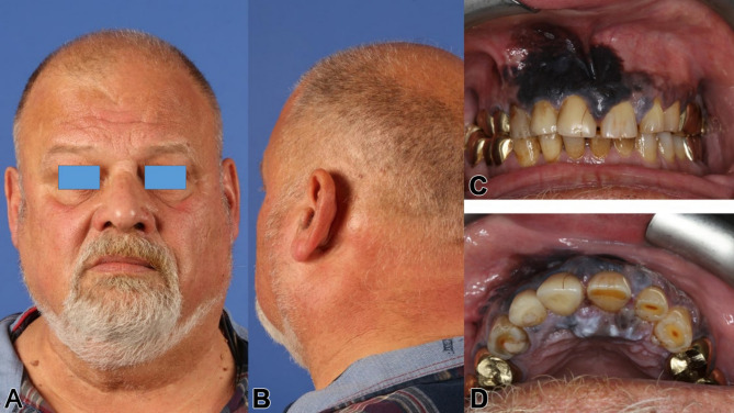 Figure 14
