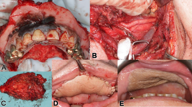 Figure 15