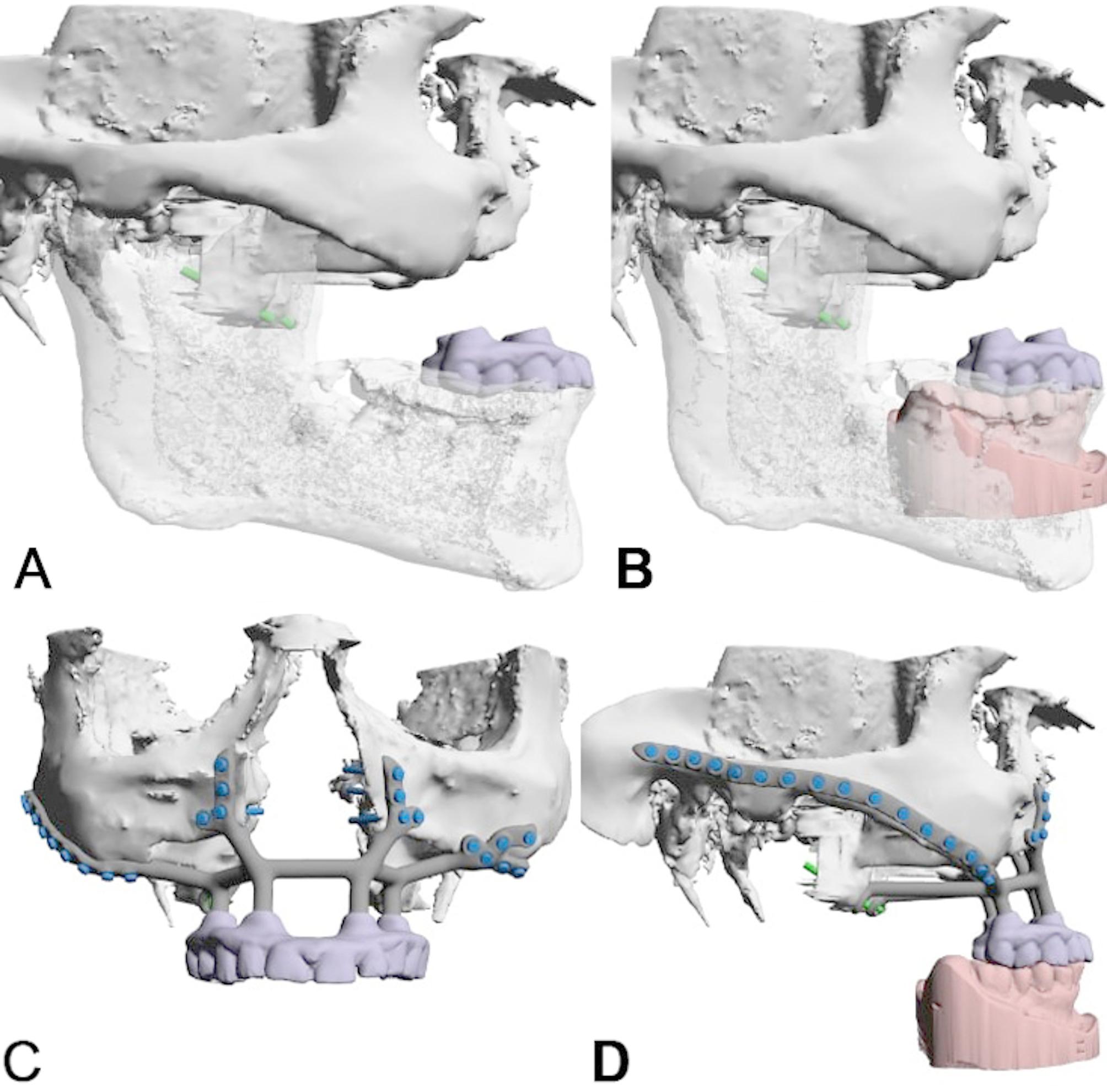 Figure 16