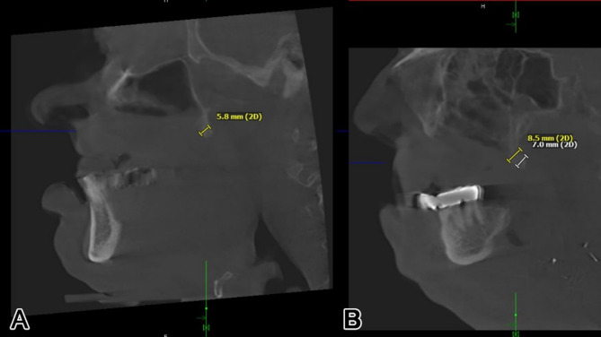 Figure 17
