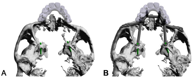 Figure 18