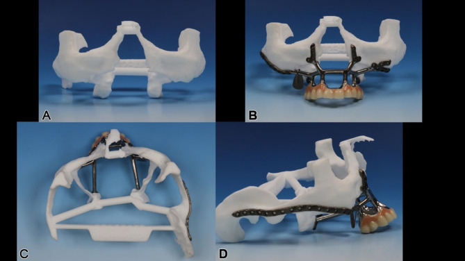 Figure 19