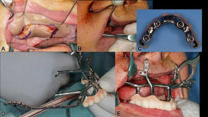 Figure 20