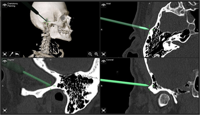 Figure 21