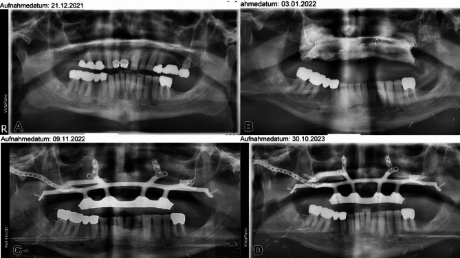 Figure 22