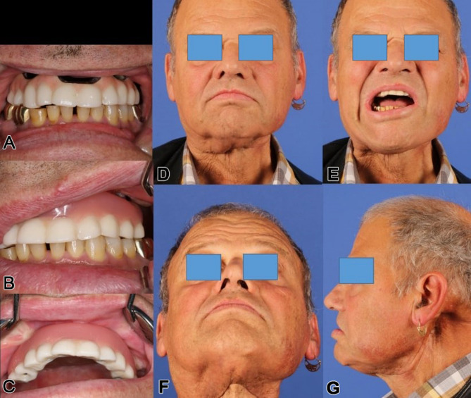 Figure 23