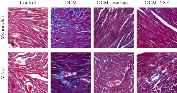 Figure 30