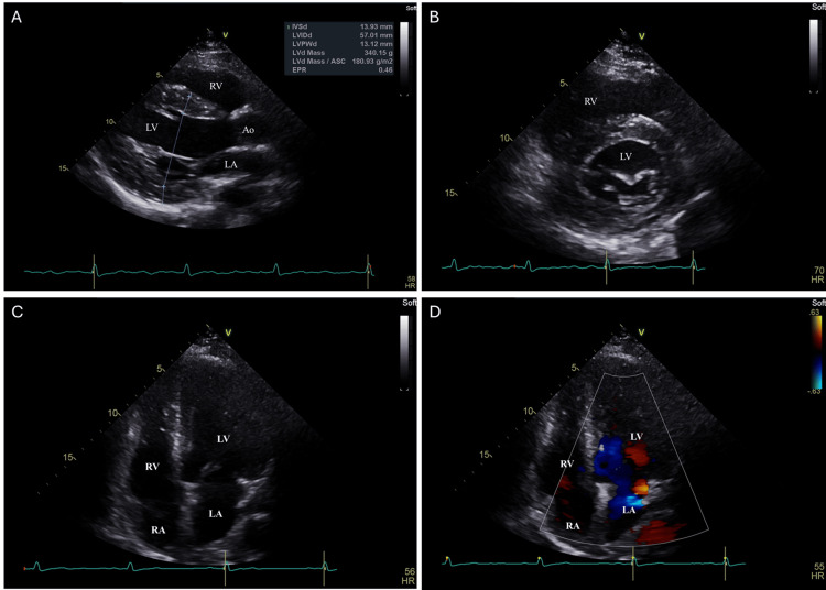 Figure 2