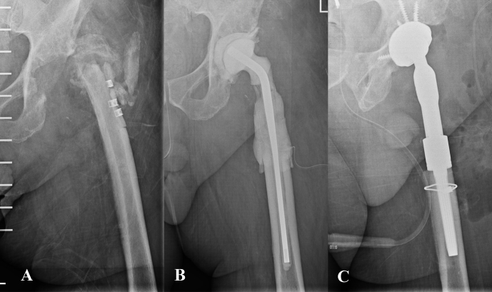 Figure 3