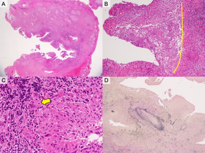 FIGURE 3
