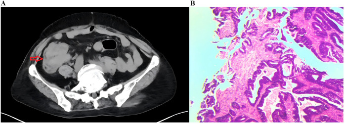 Figure 1