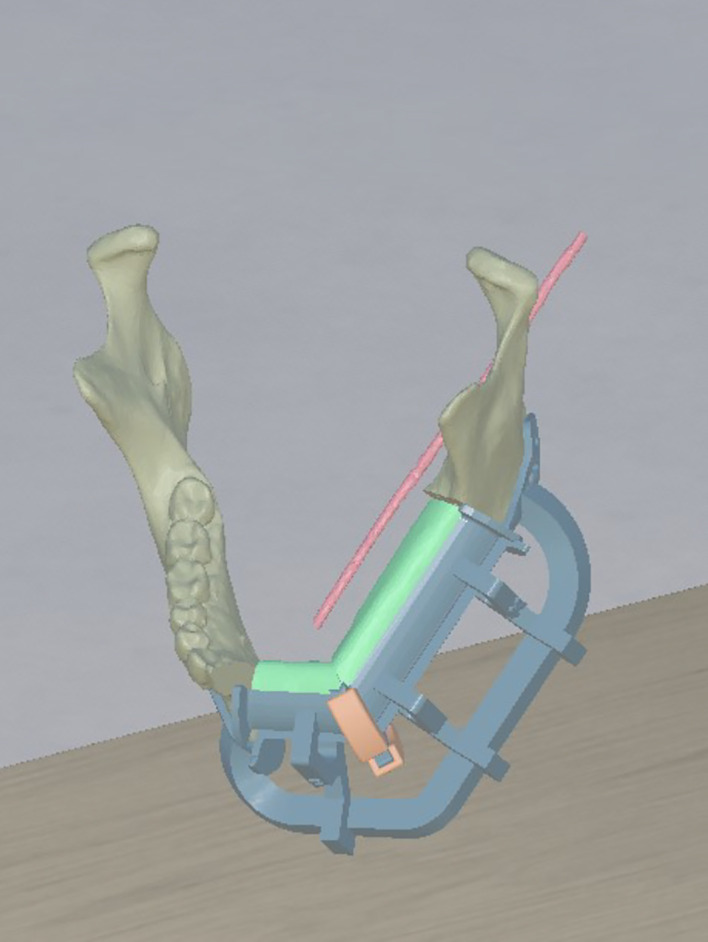 Figure 5