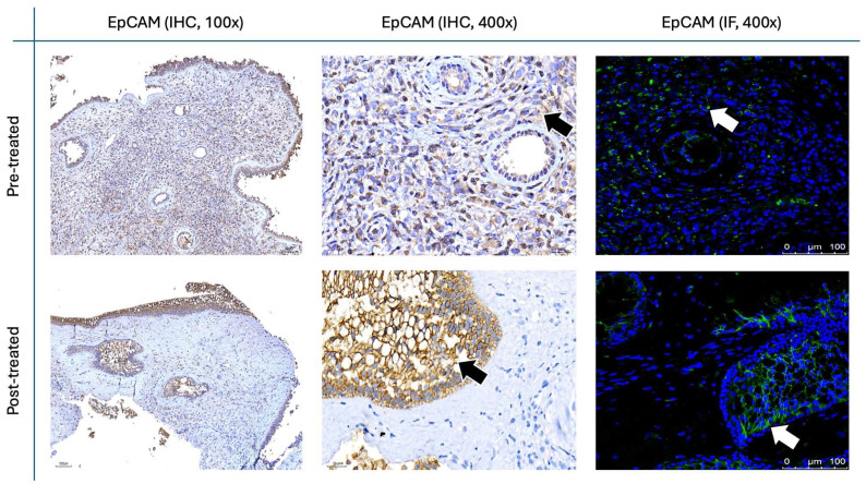 Figure 14