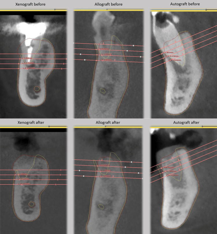 Figure 11