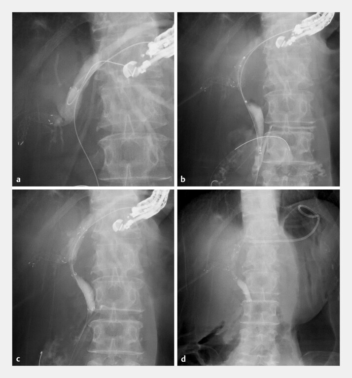 Fig. 4
