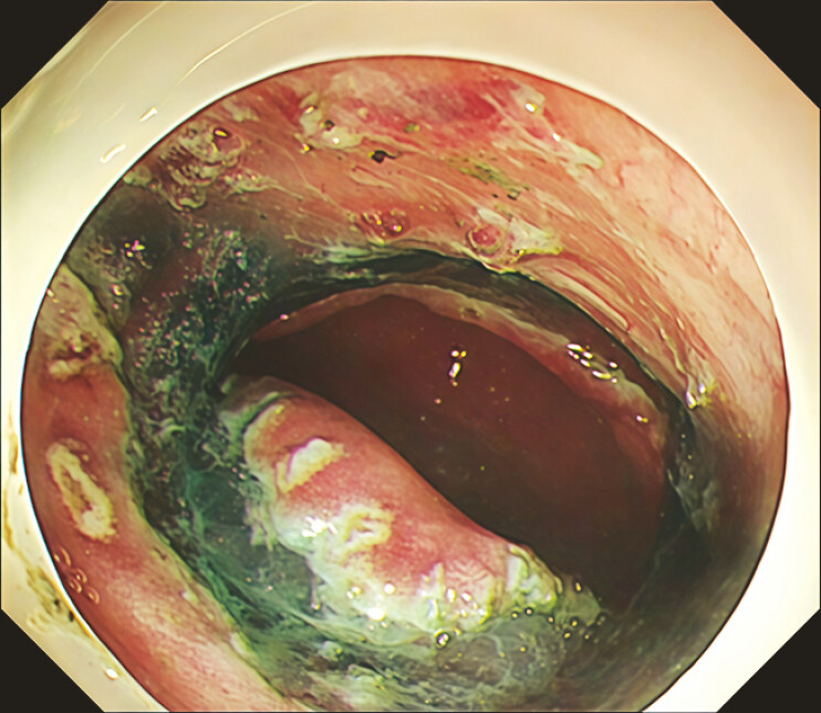 Fig. 2