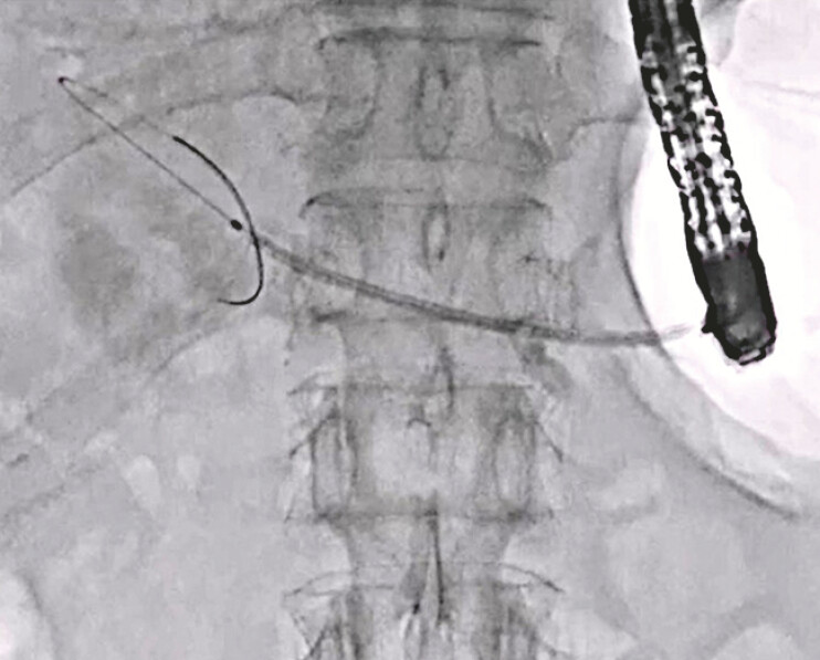 Fig. 5