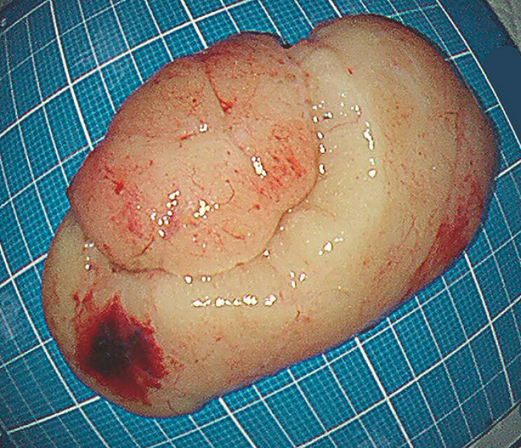 Fig. 2