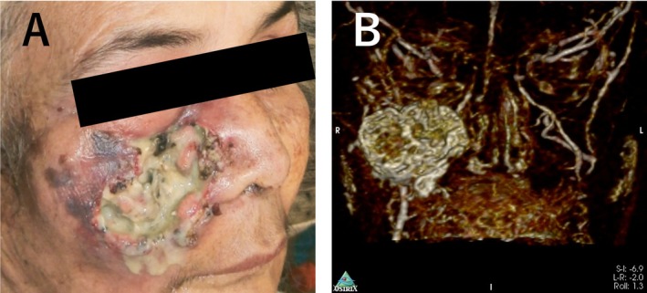 FIGURE 2