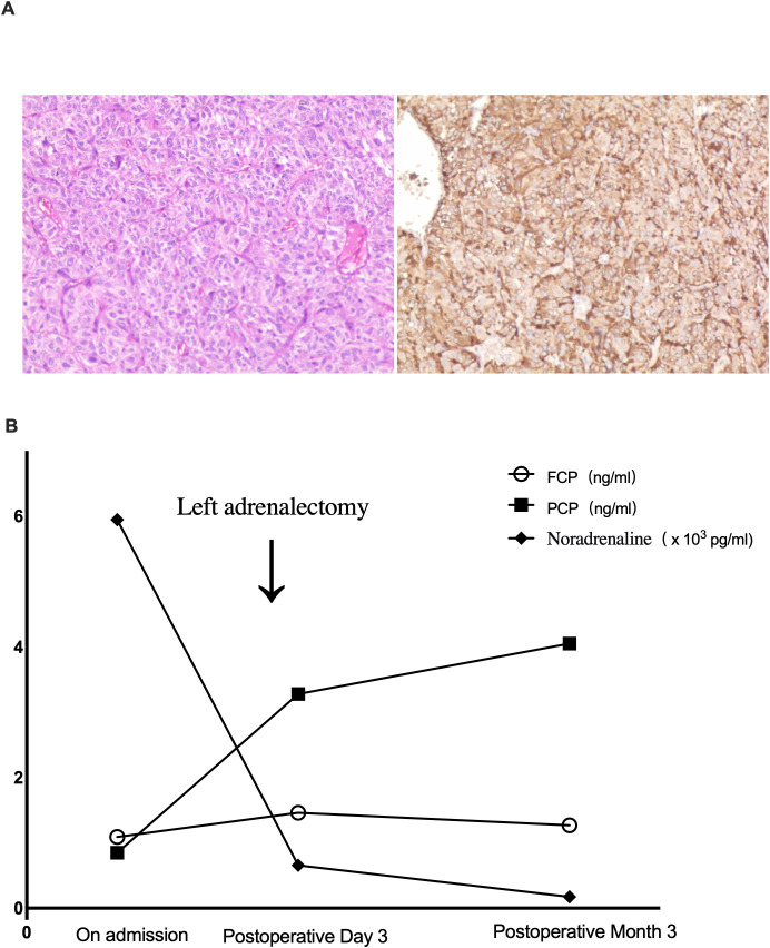 Figure 2