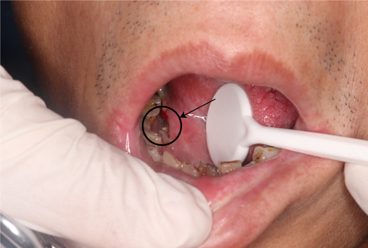 Figure 1