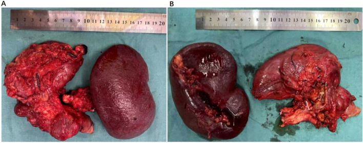 Figure 2