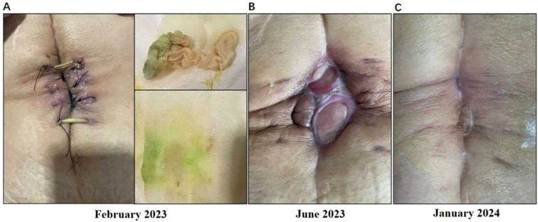 Figure 3