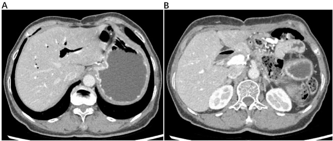 Figure 4