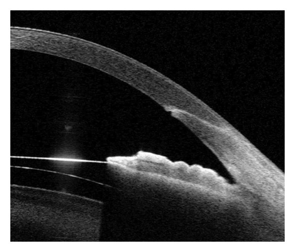 Figure 14