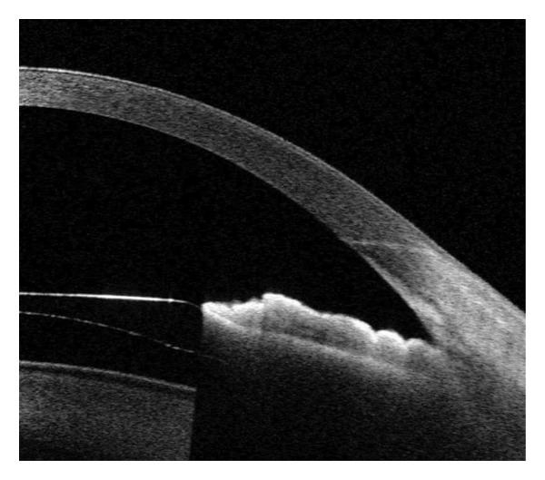 Figure 15