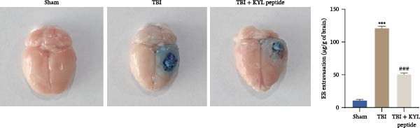 Figure 26