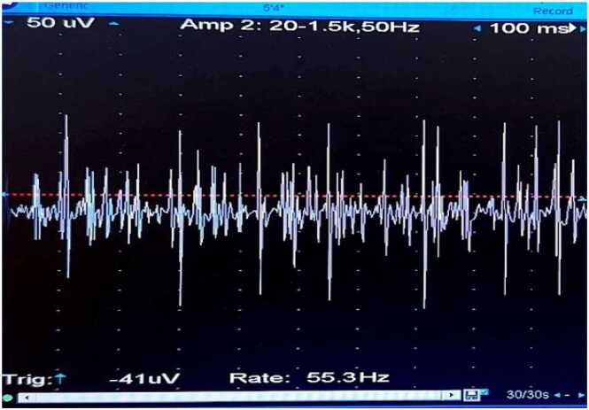 Figure 11