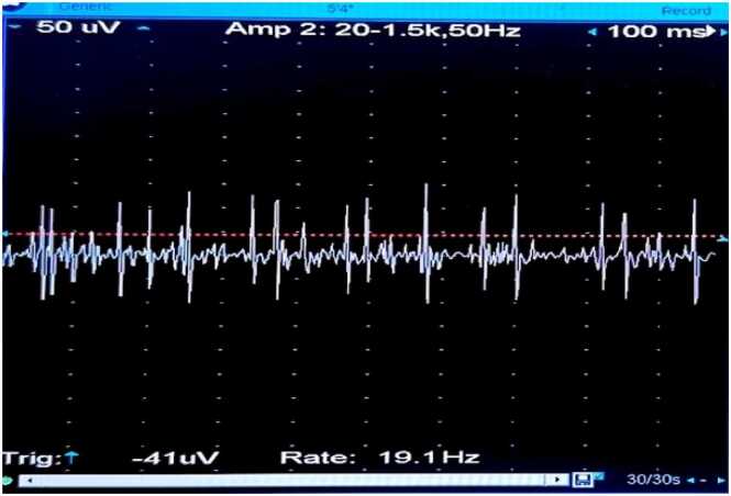 Figure 12