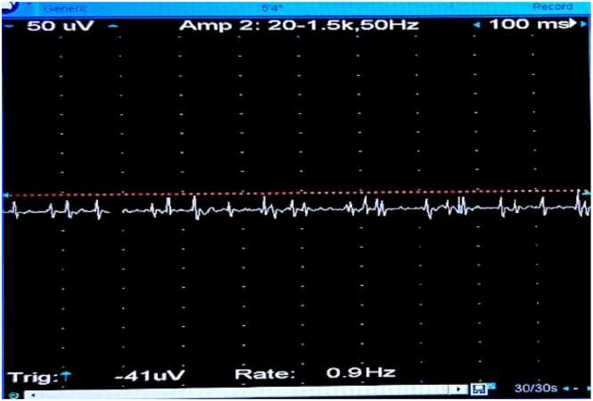 Figure 13