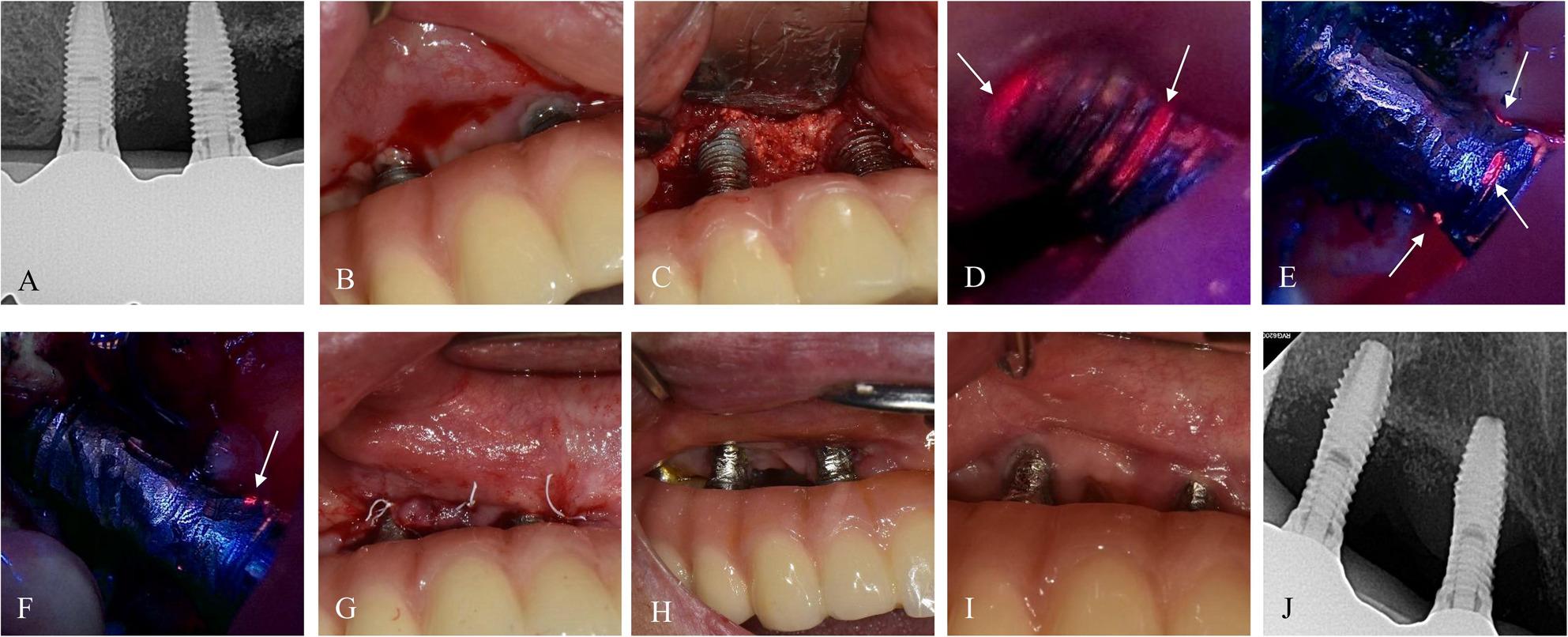 Figure 7